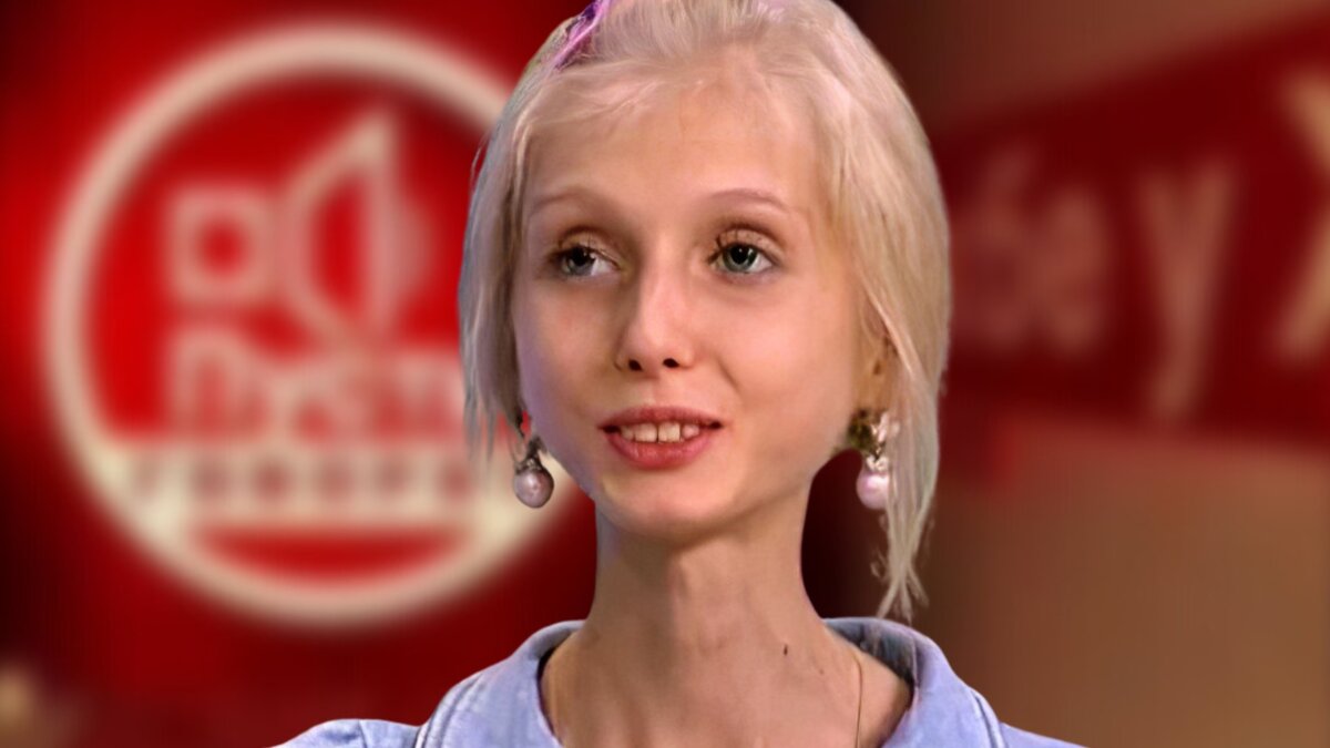 Как сейчас выглядит девушка из шоу Малахова, которая весила 20 кг? Будете в шоке