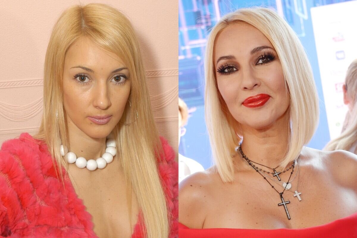 Глюкоза до и после пластики