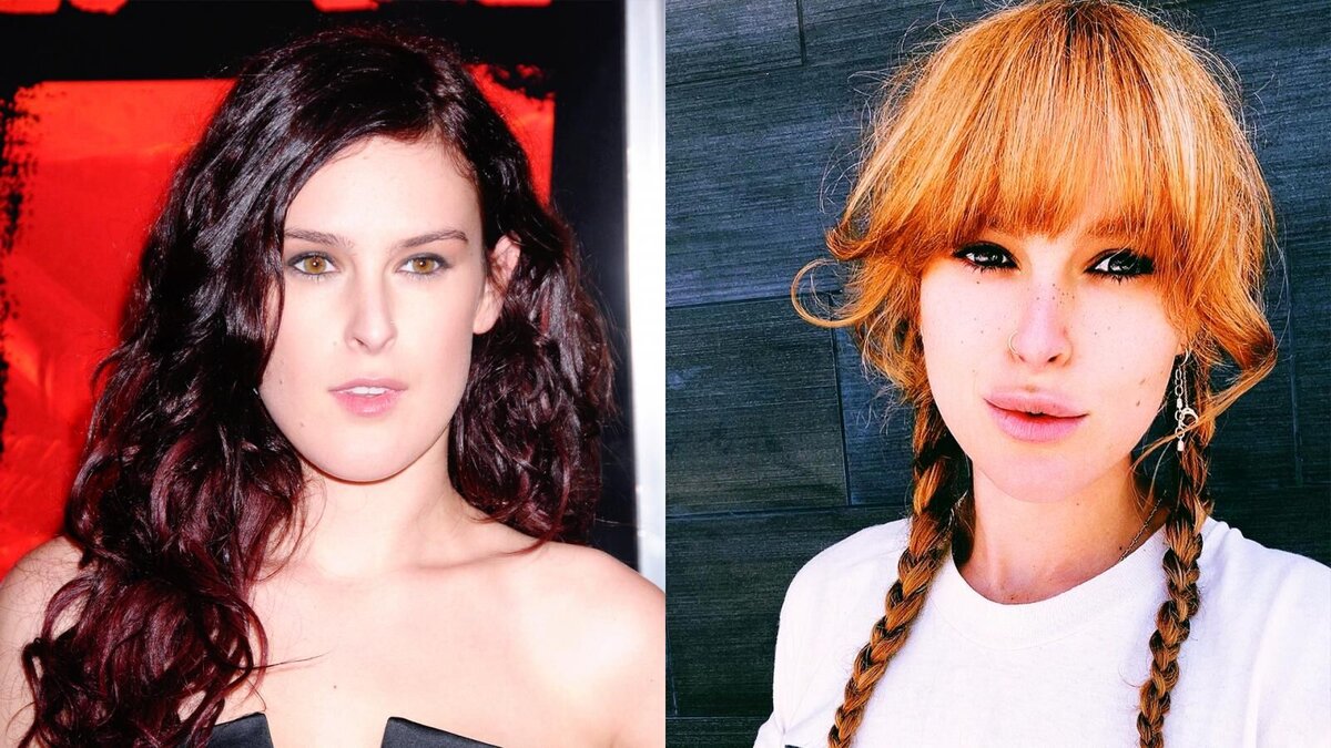 Rumer Willis Plastic Surgery: Was It A Change For the Better?