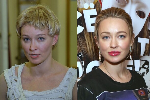 От Паниной до Михайловской: актрисы, которые сделали пластику губ и потеряли свою изюминку От Паниной до Михайловской: актрисы, которые сделали пластику губ и потеряли свою изюминку