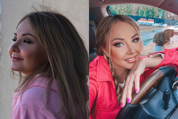 Резкое похудение, пластика и пропавший пупок: почему Дарью Пынзарь больше не узнают Резкое похудение, пластика и пропавший пупок: почему Дарью Пынзарь больше не узнают