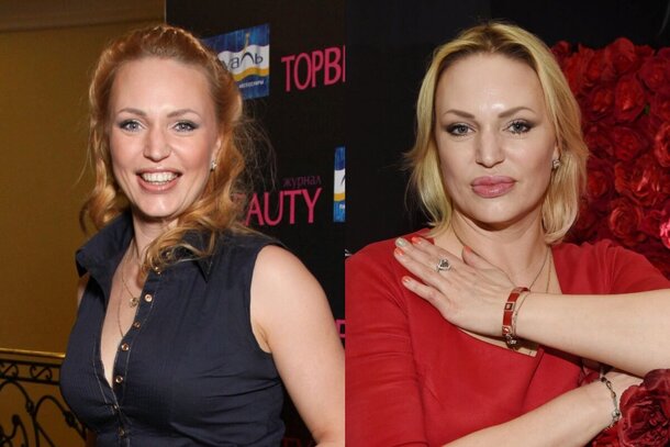 От Паниной до Михайловской: актрисы, которые сделали пластику губ и потеряли свою изюминку От Паниной до Михайловской: актрисы, которые сделали пластику губ и потеряли свою изюминку