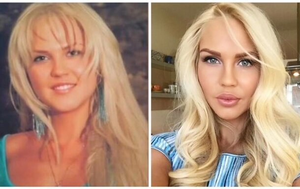 7 русских звезд, переборщивших с увеличением губ 7 русских звезд, переборщивших с увеличением губ