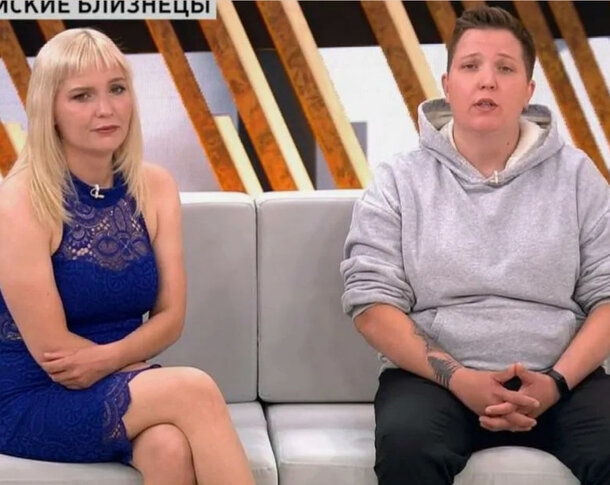 Сиамские близнецы даже рожают не как все: вот что почувствовали разделенные сестры Сиамские близнецы даже рожают не как все: вот что почувствовали разделенные сестры