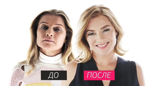 Помните блондинку из «6 кадров»? Гляньте, что с ней стало после пластики Помните блондинку из «6 кадров»? Гляньте, что с ней стало после пластики