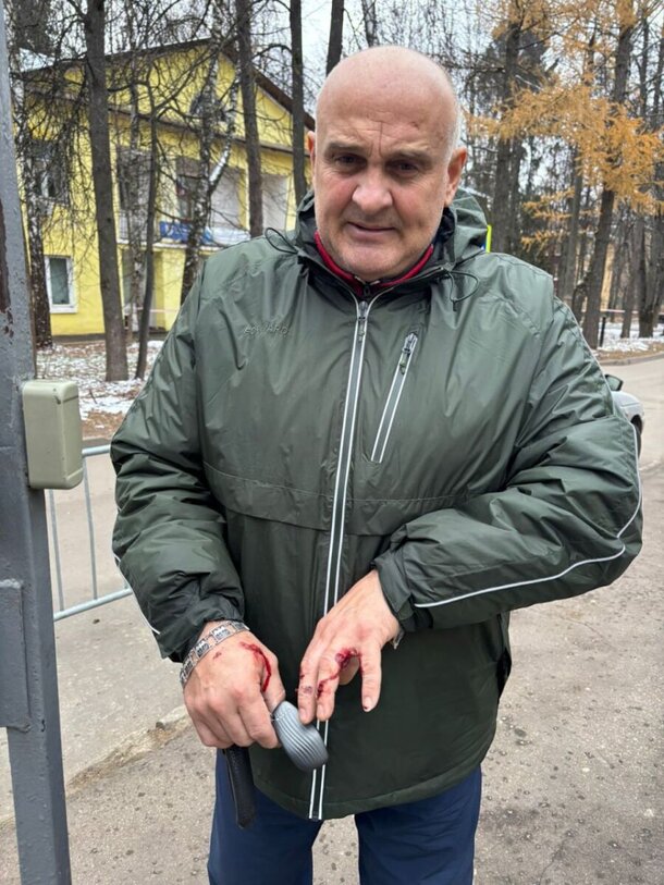 Известный актер спас двух женщин и ребенка от 120-килограммового алабая: подробности и фото Известный актер спас двух женщин и ребенка от 120-килограммового алабая: подробности и фото