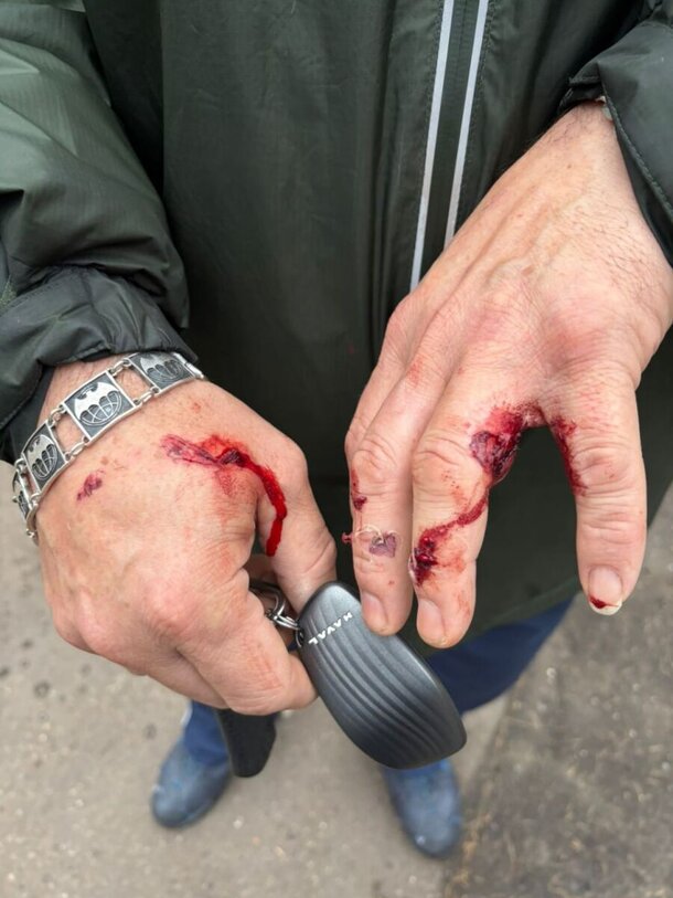 Известный актер спас двух женщин и ребенка от 120-килограммового алабая: подробности и фото Известный актер спас двух женщин и ребенка от 120-килограммового алабая: подробности и фото