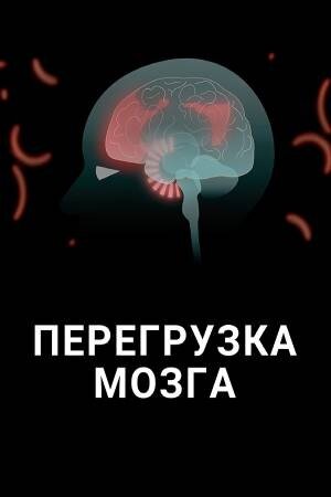 Перегрузка мозга (2016) - постер 1