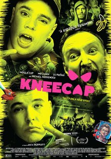 Kneecap