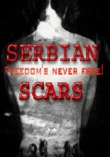 Serbian Scars