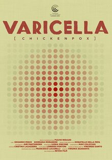 Varicella