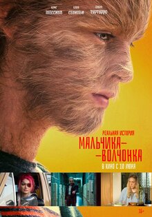 Реальная история мальчика-волчонка