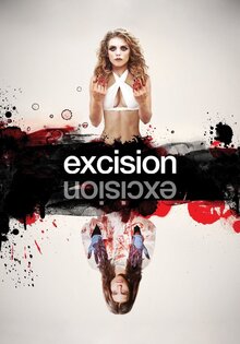 Excision