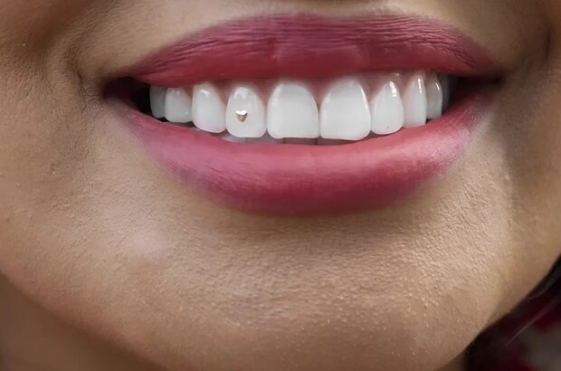 Open Wide (2024) - photo 1