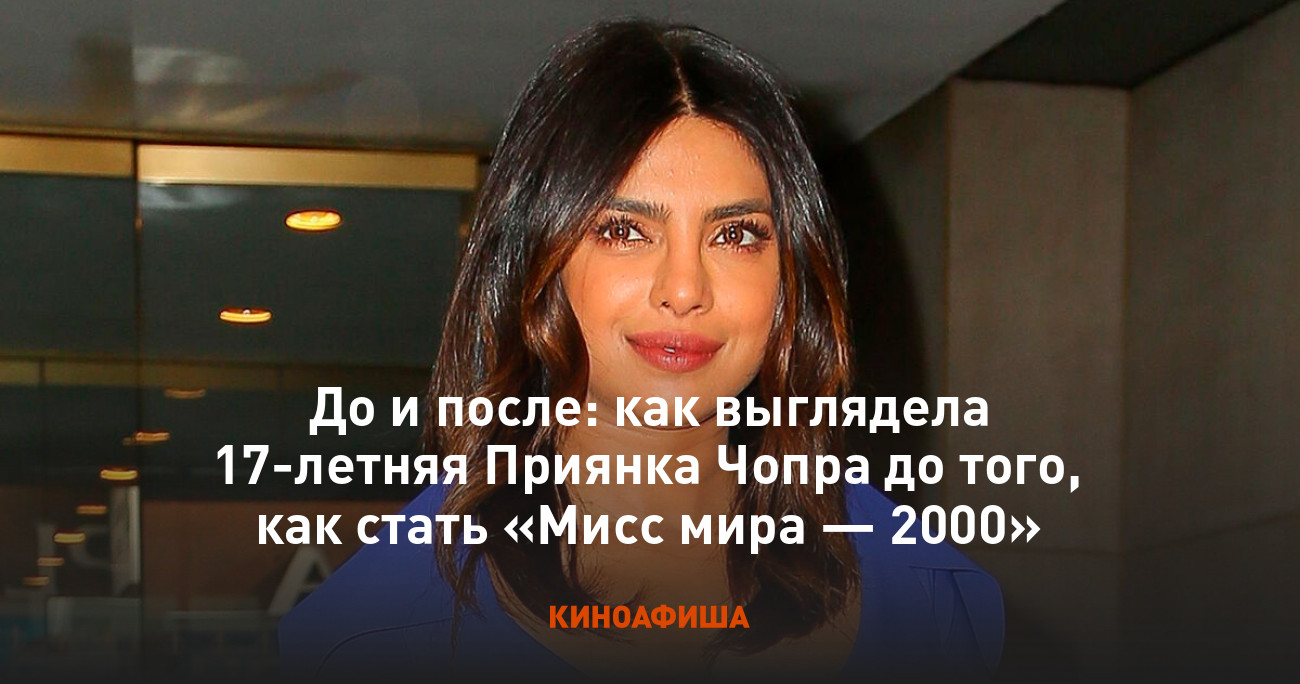 Приянка Чопра До Пластики И После Фото