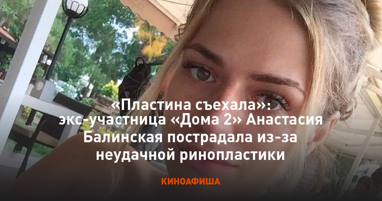 Пластина съехала»: экс-участница «Дома 2» Анастасия Балинская пострадала  из-за неудачной ринопластики