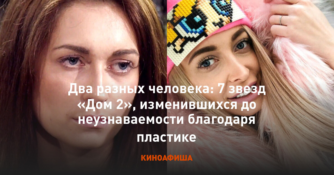 Два разных человека: 7 звезд «Дом 2», изменившихся до неузнаваемости  благодаря пластике