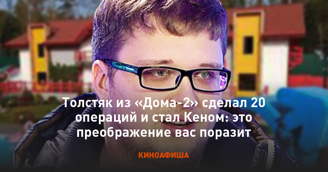 Толстяк из «Дома-2» сделал 20 операций и стал Кеном: это преображение вас  поразит