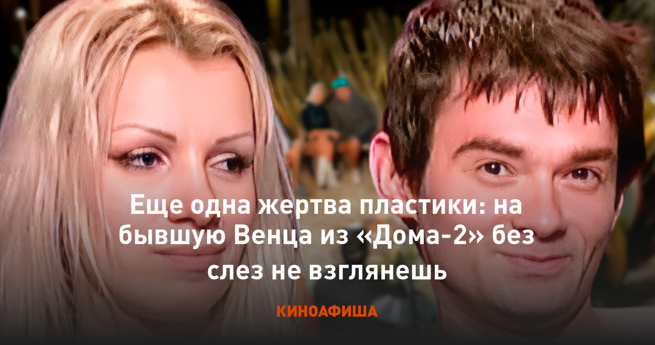 Еще одна жертва пластики: на бывшую Венца из «Дома-2» без слез не взглянешь