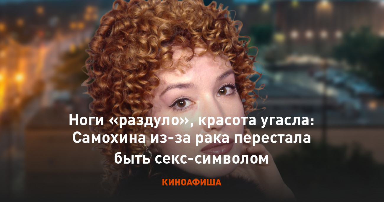 Ноги «раздуло», красота угасла: Самохина из-за рака перестала быть  секс-символом