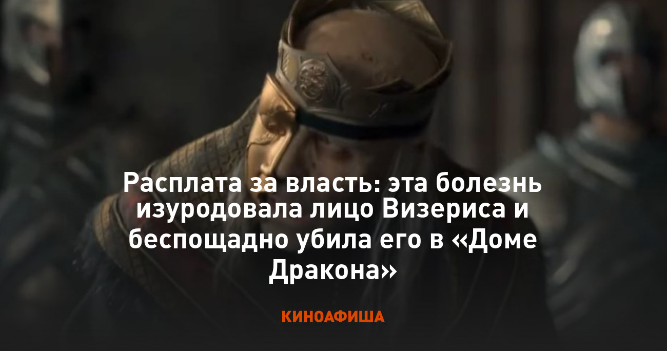 Расплата за власть: эта болезнь изуродовала лицо Визериса и беспощадно  убила его в «Доме Дракона»